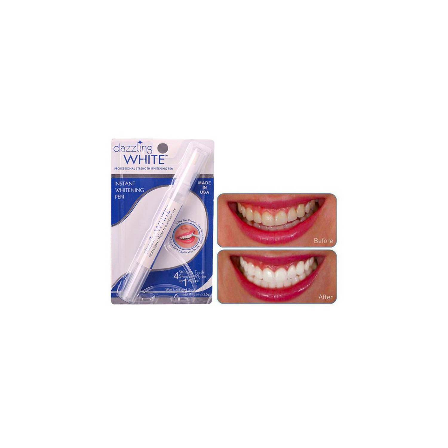 Lápiz Blanqueador Dental Instantáneo Dientes Peróxido