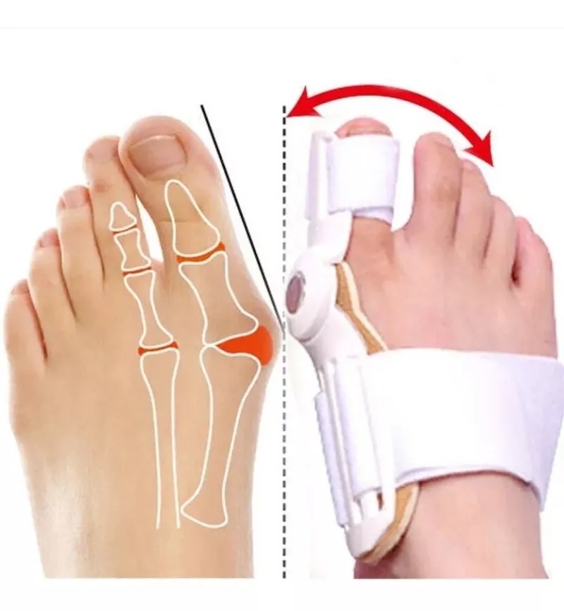 Ferula Corrector De Juanetes Hallux Valgus Ortesis