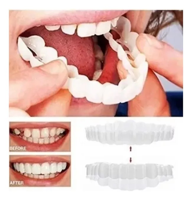 Carillas Dentales Postizos Temporales Dentadura