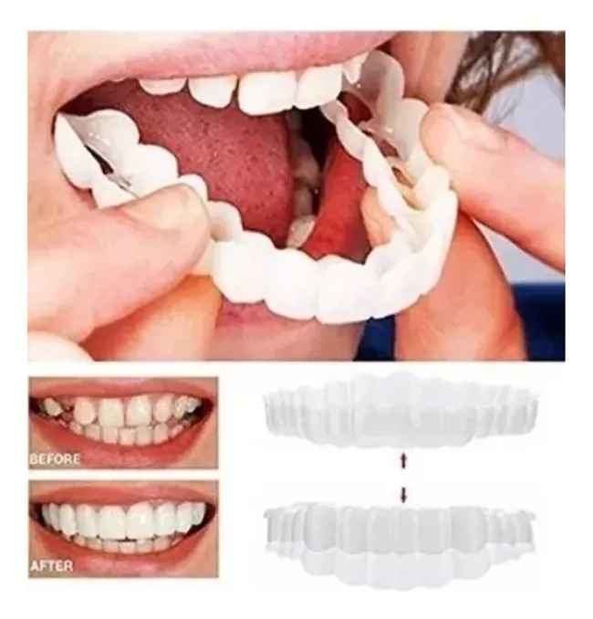 Carillas Dentales Postizos Temporales Dentadura